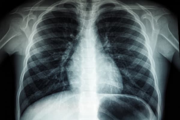 Tired of being tired